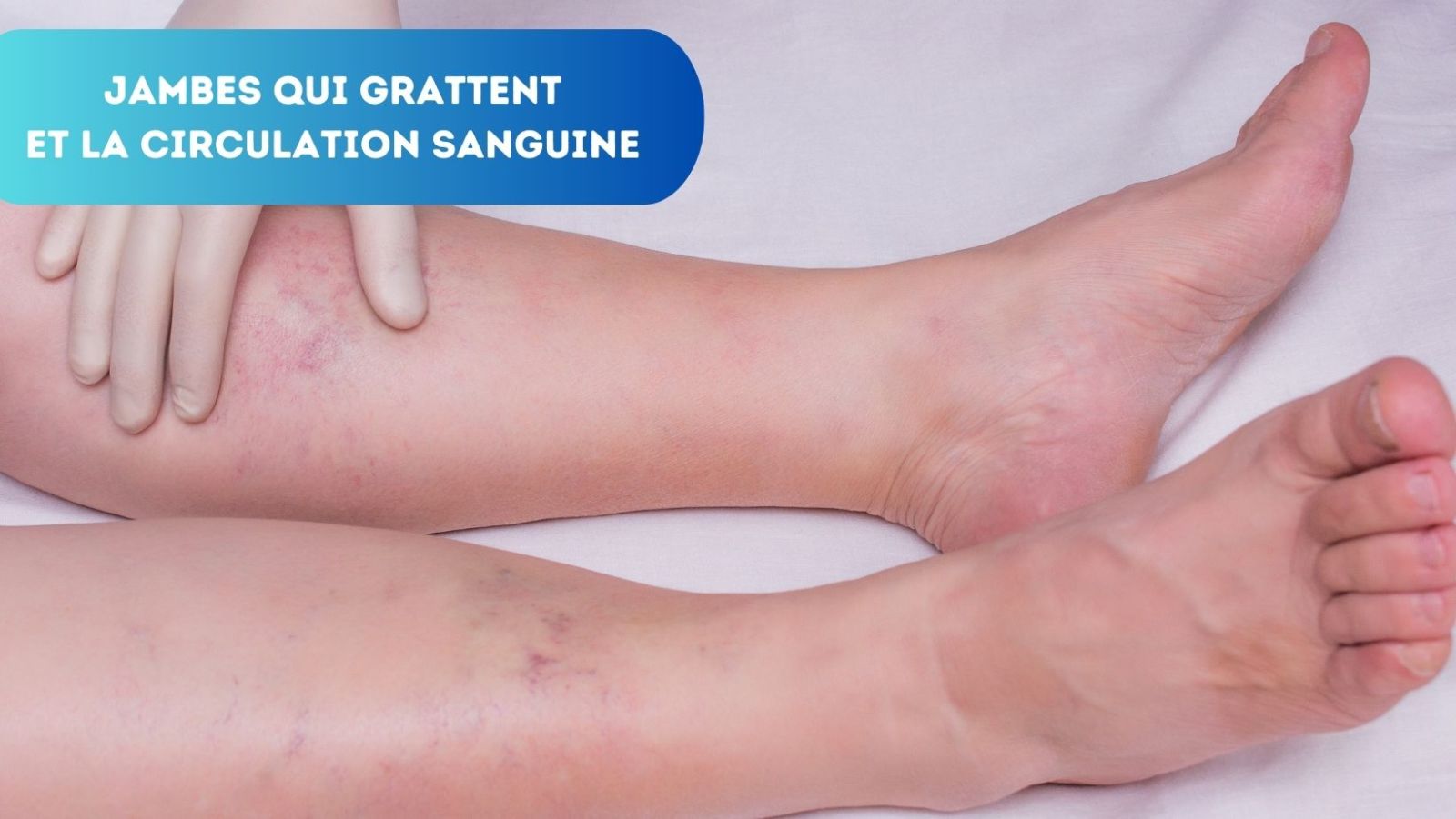 Jambes qui grattent et circulation sanguine J
